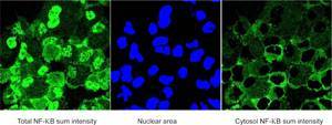 Quantification de l'expression de NFkappaB